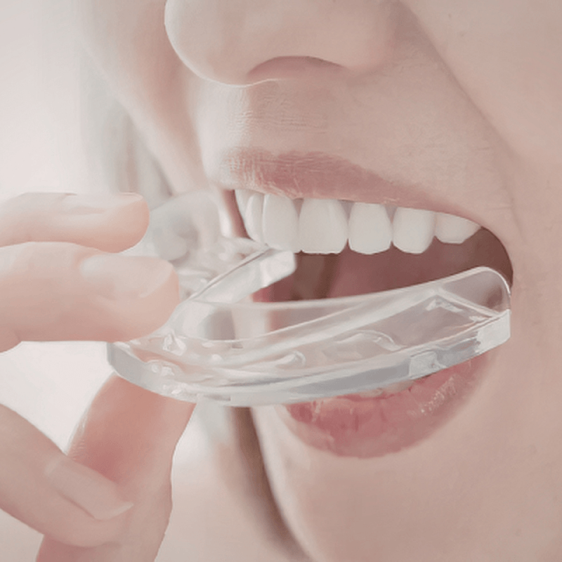 Sports Mouthguards in Ahmedabad