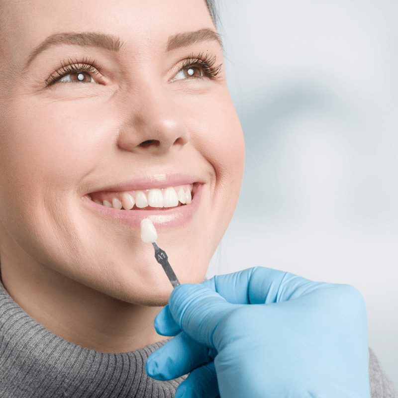 Dental Veneers at Vora Dental Clinic